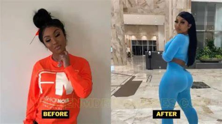 Ari Fletcher Plastic Surgery. Pregnancy Details, BeforeAfter, And