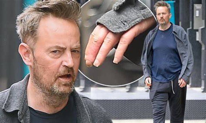 Matthew Perry Shortened Middle Finger
