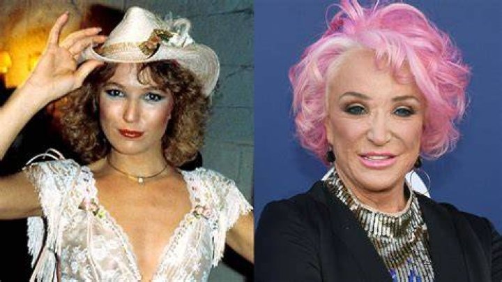 Tanya Tucker Plastic Surgery Totally Changed Her Face