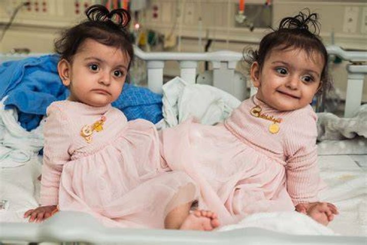 Twins with 'love for plastic surgery and fillers' used to look a lot